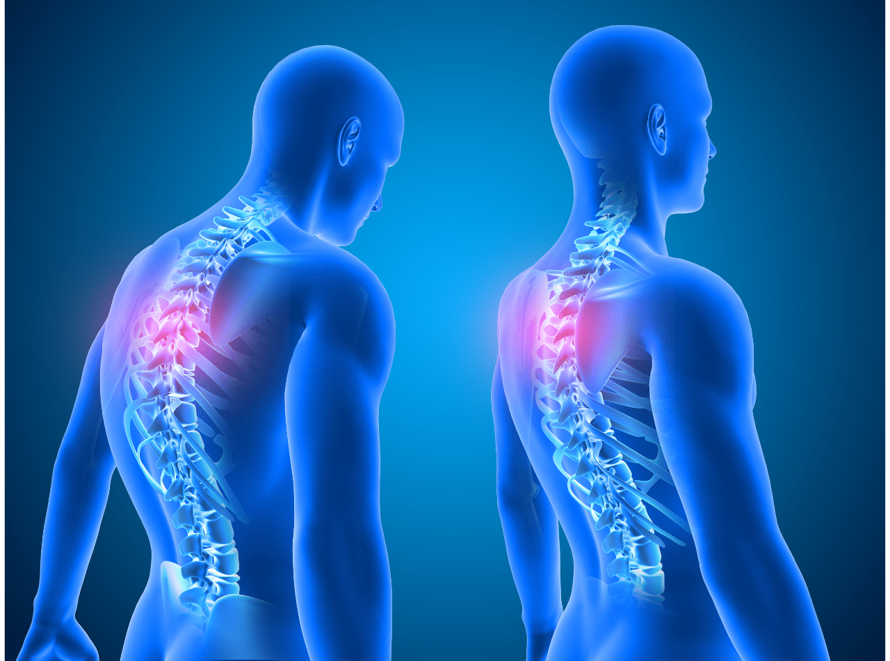 Postura e benessere-i vantaggi della riprogrammazione neuro posturale per la salute